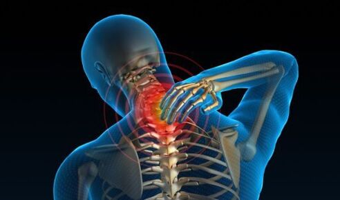 Pain in the cervical spine with osteochondrosis