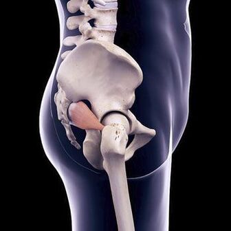 Dagger back pain can be due to spasm of the piriformis muscle