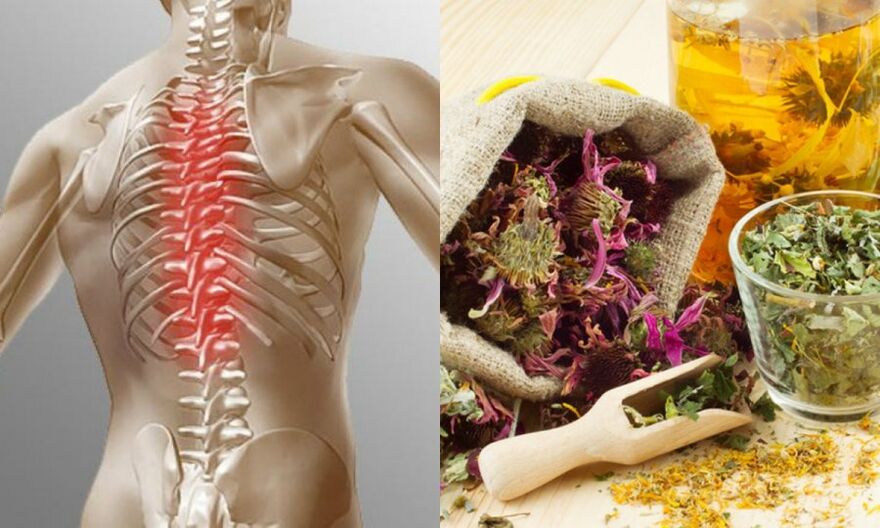 Traditional recipes – prevent the development of osteochondrosis and support the health of the spine