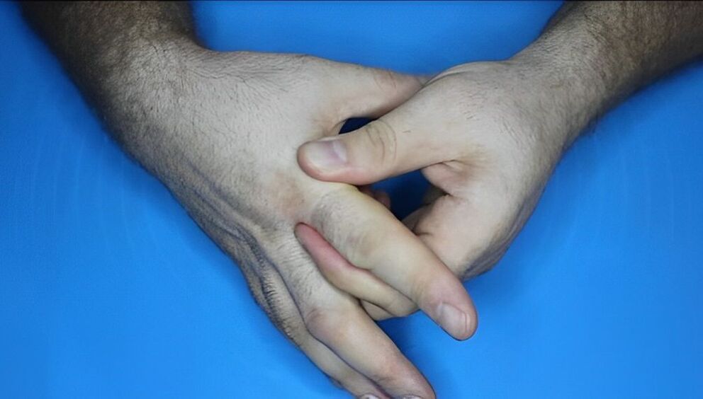 Exercises for fingers with osteoarthritis