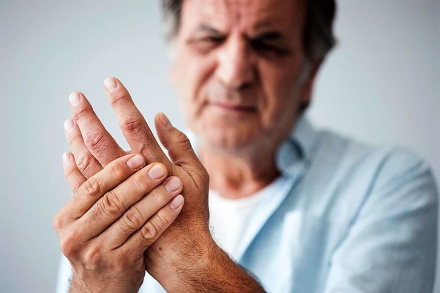 Signs of hand arthritis