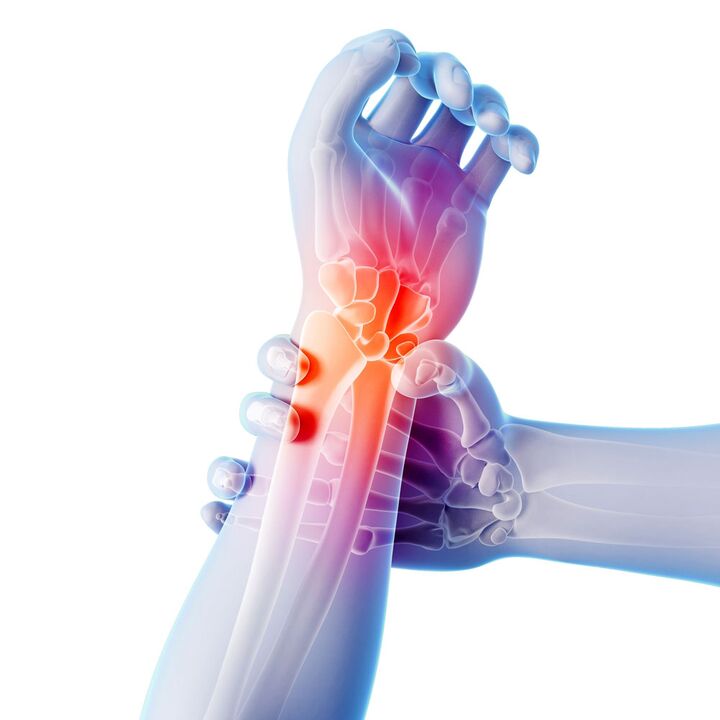 Osteoarthritis