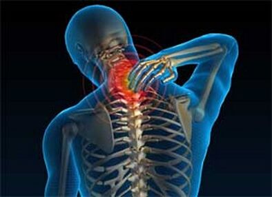The pain in the neck is a common symptom of osteochondrosis
