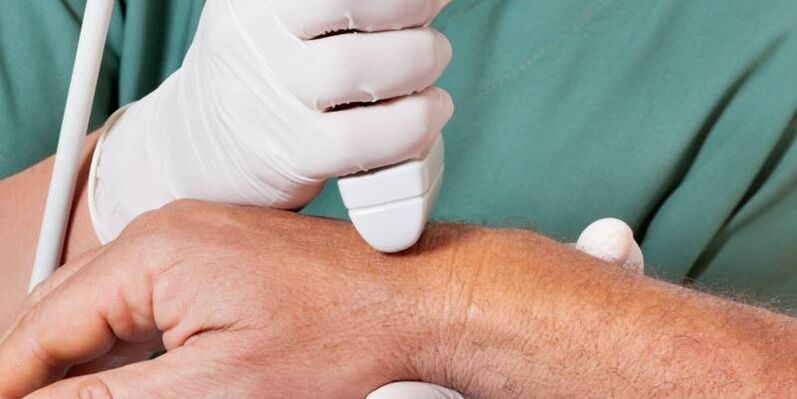 Arthritis as the causes of pain in the fingers joints